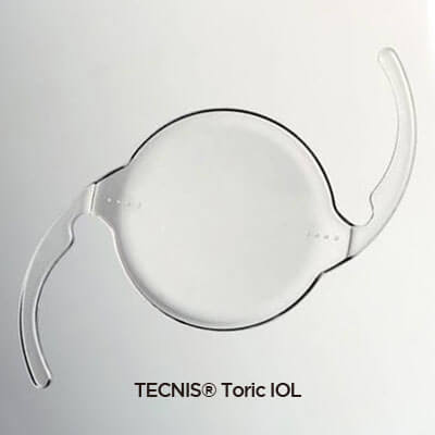 백내장 난시 수술