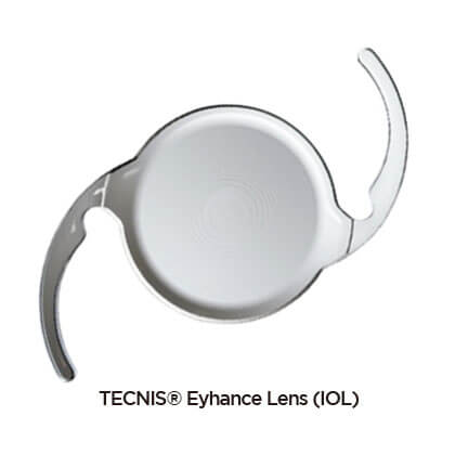 아이핸스 삽입술