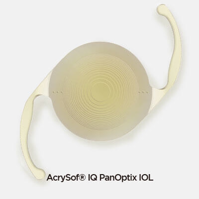 백내장 노안 난시 수술 백내장 노안 난시 수술