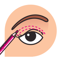 blepharoplasty-prss-1