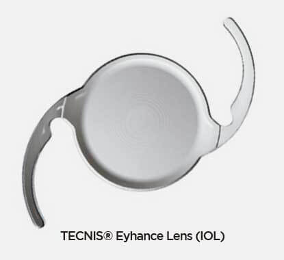 아이핸스 삽입술