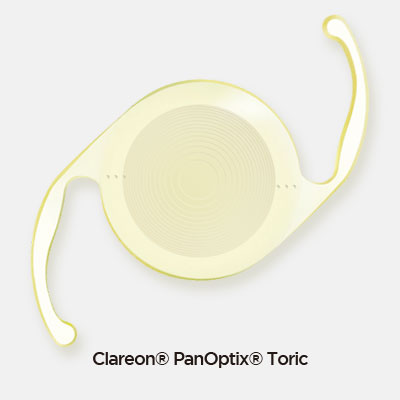 클라레온 토릭 렌즈